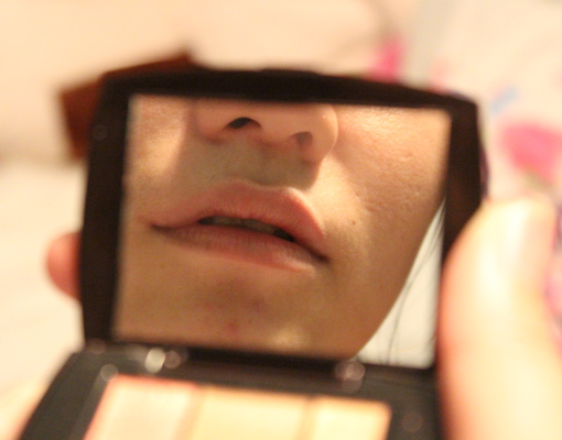Microneedling Lip Care Treatment